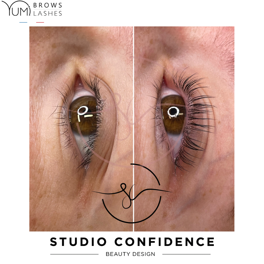 Lashlift