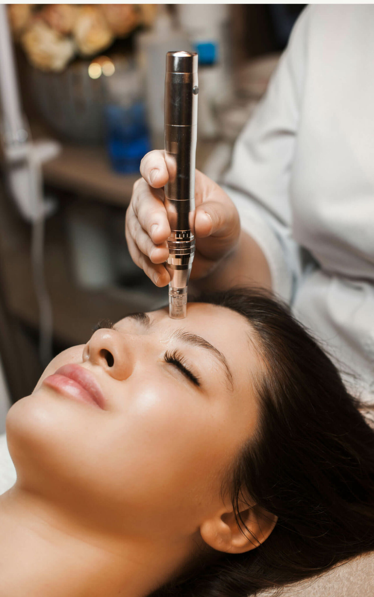 Microneedling
